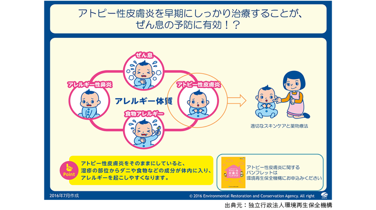 小児アレルギー