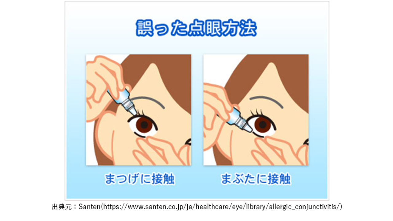 アレルギー性結膜炎03