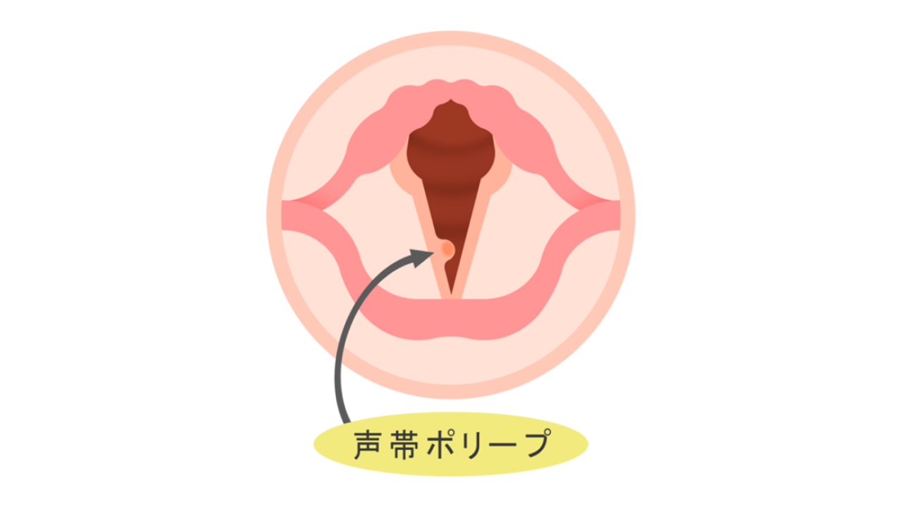 音声02