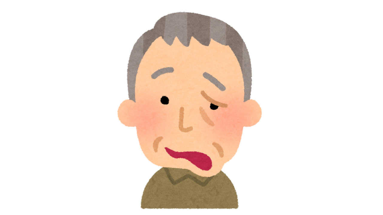 顔面神経麻痺01