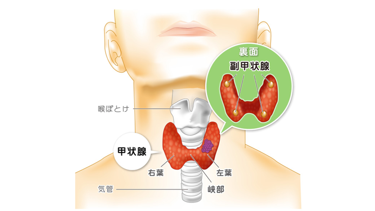 頭頸部癌03